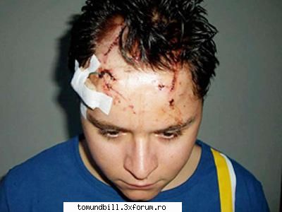 Tobosarul Tokio Hotel, dus de urgenta la spital - lavi_th - Gustav Schaefer